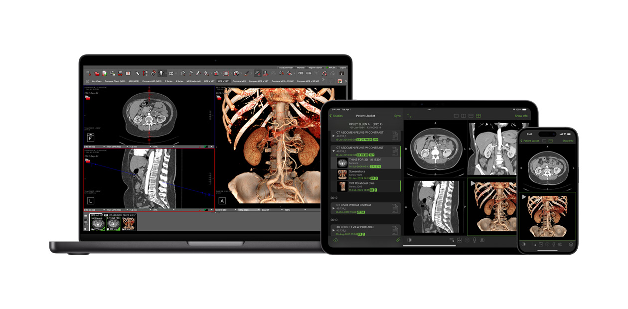 Software viser Visage-appen, som radiologer bruger til at analysere store diagnostiske filer.
