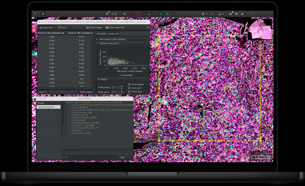 Écran de MacBook Pro affichant QuPath et Instanseg